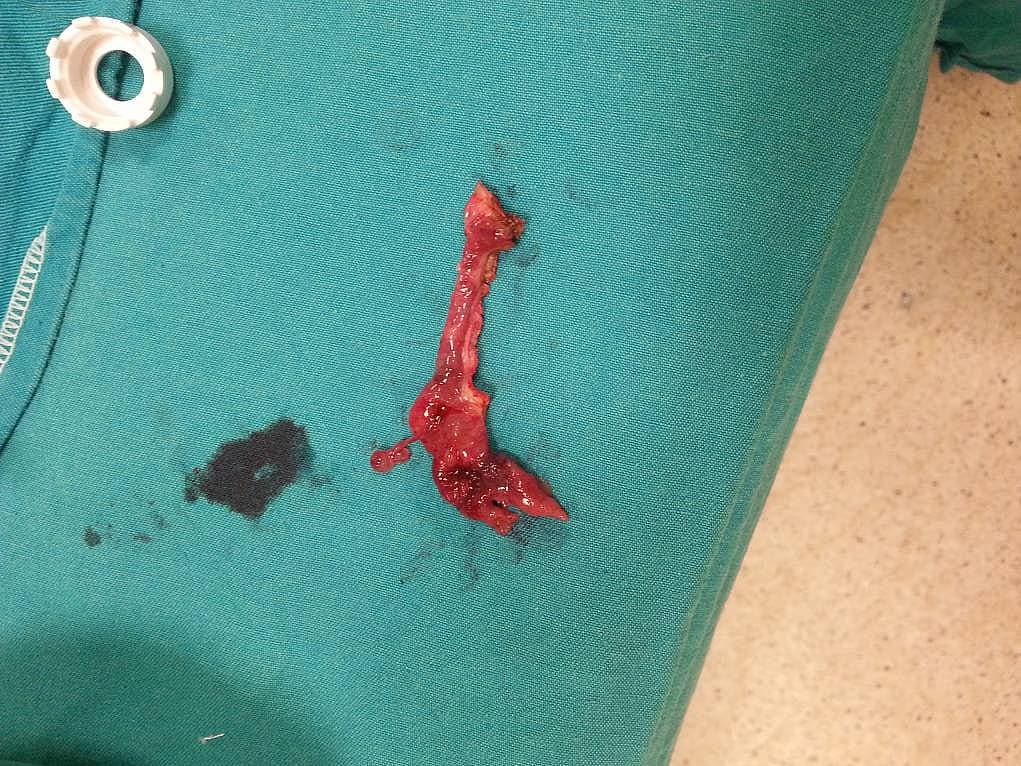 12. Birebir gözlem yapma imkanı.